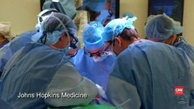 VIDEO: Transplantasi Penis Pertama di Dunia