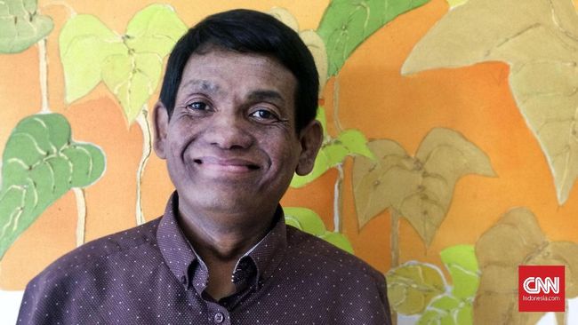 Sejak tiga tahun lalu, Rodi Susilo, pasien transplantasi hati menuturkan dirinya menjalani hidup dengan donor hati dari sang istri, Dhelistya Liza.