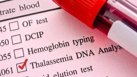 Cegah Thalassemia dengan Skrining Sebelum Menikah