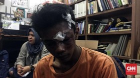 Warga Babak Belur Dihajar saat Pengosongan KPAD Tanah Kusir