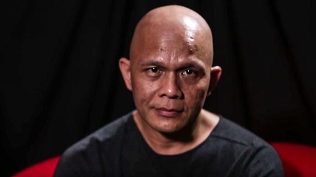 Pembawa acara Dunia Lain, Harry Pantja, mengungkapkan kondisi kesehatannya usai menjalani terapi akibat stroke.