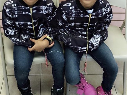 Cantik! Potret si Kembar Bermata Indah