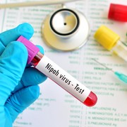Sekolah dan Kantor di India Terpaksa Libur Gegara Virus Nipah, Ini Pengertian dan Gejalanya!