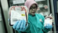 Tertular HIV Lewat Transfusi Darah, Kok Bisa? Ini Kata PMI