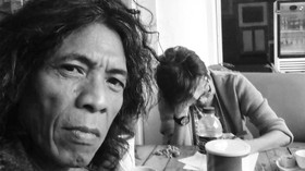 Musisi Senior Ari Malibu Dirawat di ICU karena Kanker