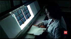 VIDEO: Potensi Pengobatan Kanker Payudara Tanpa Kemoterapi