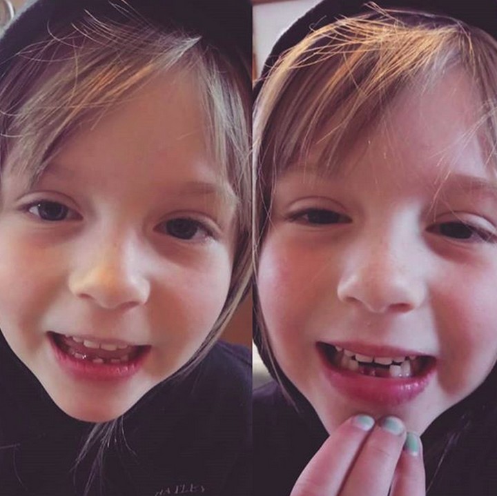 <p>Ceritanya, ini before after gigi si kecil tanggal, Bun. Meski giginya copot dua, dia tetap cute kan? (Foto: Instagram/@rossemcvety)  </p>