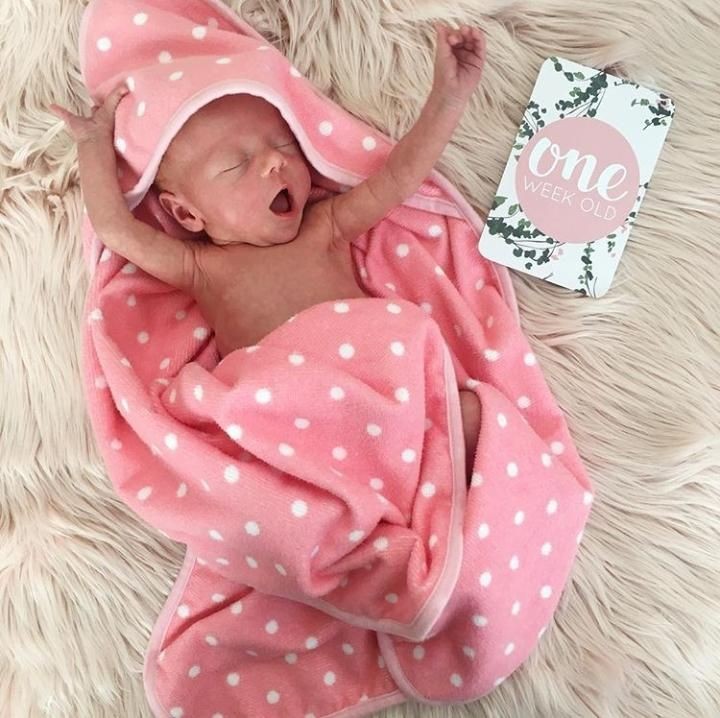 Baby Allie, begitu nama panggilan bayi cantik ini. Hoam, ngantuk ya, Nak? (Foto: Instagram @lamamatropicana)