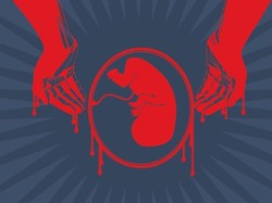 Praktik Aborsi di Surabaya yang Dibongkar Polisi Libatkan Tenaga Kesehatan