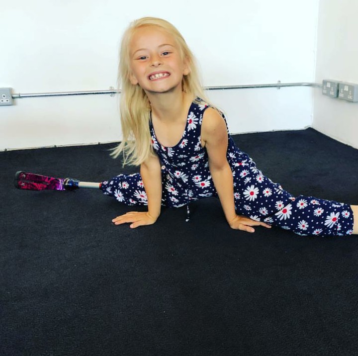 <p>Hal inilah yang membuat kehilangan Daisy-May kakinya di usia dini karena harus diamputasi. (Foto: Instagram/daisy_maydemetre_zebedee)</p>