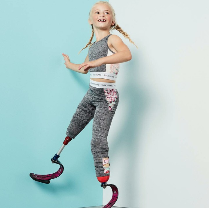 <p>Akan tetapi kehilangan kaki nggak buat Daisy menyerah sama keadaan. Ia berjuang keras dan kini ia menjadi model lho. (Foto: Instagram/daisy_maydemetre_zebedee)</p>