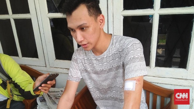 Korban pelemparan batu di jalan tol Tamer memperkirakan pagar yang bolong menjadi salah satu penyebab pemuda iseng melemparkan batu ke arah jalanan.