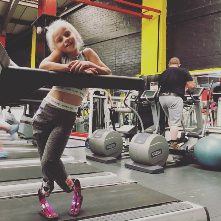 <p>Daisy-May lahir dengan kondisi yang disebut fibular hemimelia. Ini merupakan cacat lahir yang membuat sebagian atau seluruh tulang fibula di kaki hilang. (Foto: Instagram/daisy_maydemetre_zebedee)</p>