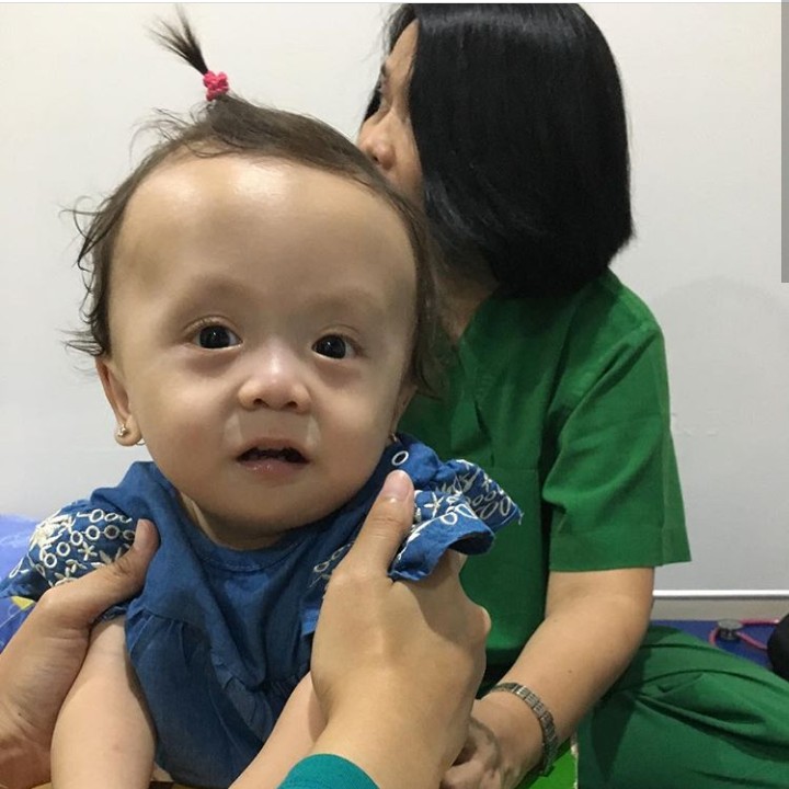 <p>Ini dia Ziona Eden Alexandra Panggabean, putri bungsu Joanna Alezandra. Di usia 11 bulan, Zio, panggilan akrabnya, didiagnosis campomelic dysplasia (CMD) yang merupakan penyakit langka. (Foto: Instagram @joannaalexandra)</p>