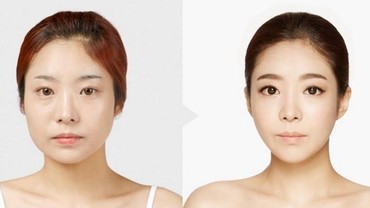 img-title Vaksin Segera Datang, Wanita Korea Buru-buru Operasi Plastik, Kenapa?