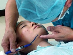 Korsel Hentikan Insentif Pajak Operasi Plastik, Wisata Medis Terancam Lesu