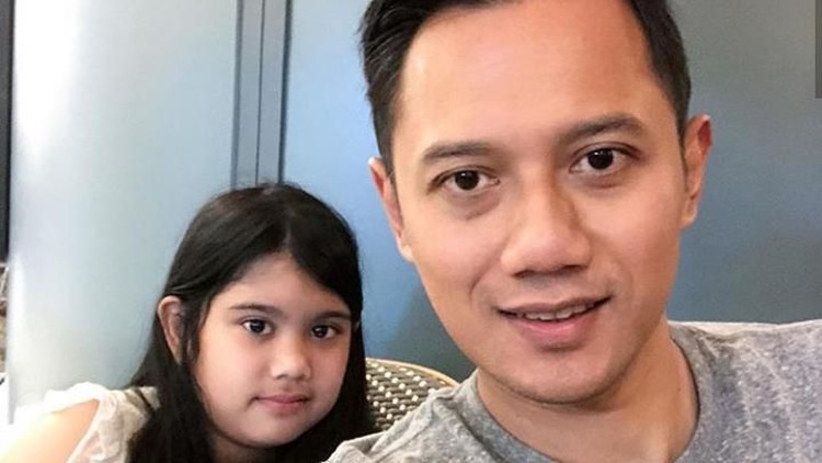 Aira, putri Agus Yudhoyono mengalami patah tulang di kaki. Agus menemani putrinya belajar menggunakan tongkat yang harus digunakan Aira selama patah tulang.