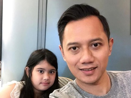 Anak Patah Tulang, Agus Yudhoyono Temani Belajar Menggunakan Tongkat