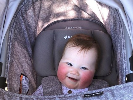 Foto: Bayi 'Pipi Tomat' yang Super Menggemaskan