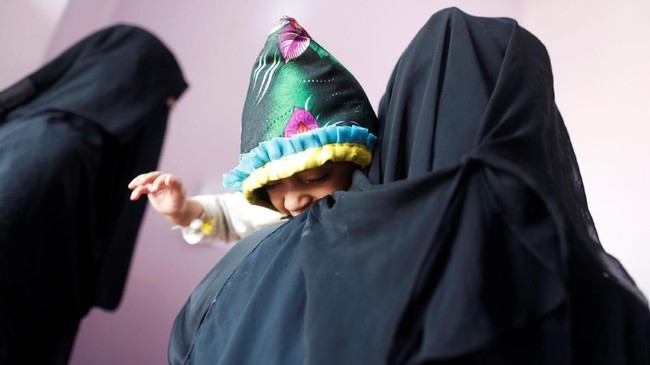 FOTO: Kisah Pilu Anak-anak Yaman Malnutrisi Korban Perang