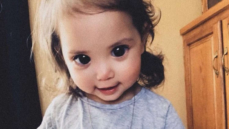 Anak perempuan ini memiliki bermata besar dan indah. Tidak disangka ia ternyata memiliki kondisi langka.