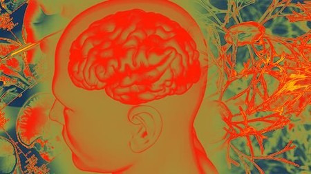 Melawan Belenggu Demensia