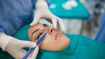 SYARAT OPERASI PLASTIK HIDUNG