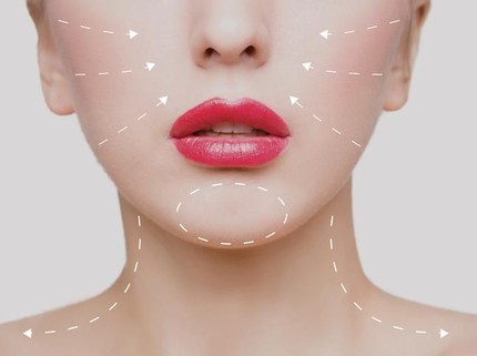 Bunda Wajib Tahu 3 Risiko Operasi Plastik di Atas Usia 40 Tahun