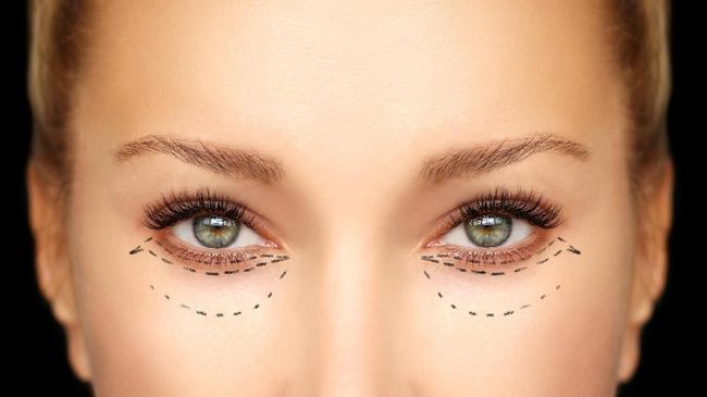 Penyanyi Titi DJ melakukan operasi anti aging di Korea Selatan. Operasi anti aging Titi DJ ini dilakukan agar terlihat lebih segar dan awet muda.