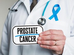 Hidup Sehat Kok Kena Kanker Prostat? Ini Penjelasan Dokter