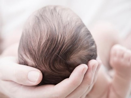 5 Penyebab Rambut Bayi Rontok