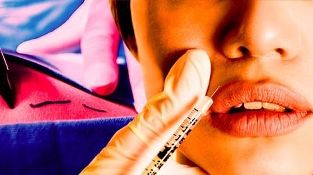 Drama Pelik Operasi Plastik 