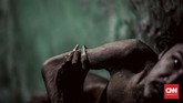 FOTO: Menyelamatkan Asep dari Borgol Jiwa Gangguan kesehatan jiwa skizofernia bisa dialami sejak dini, seperti kisah Asep Kosasih yang kini telah dipasung 22 tahun.