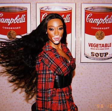 7 Model Keren yang Dobrak Standar Kecantikan