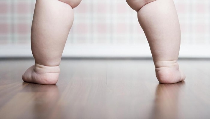 ilustrasi anak obesitas