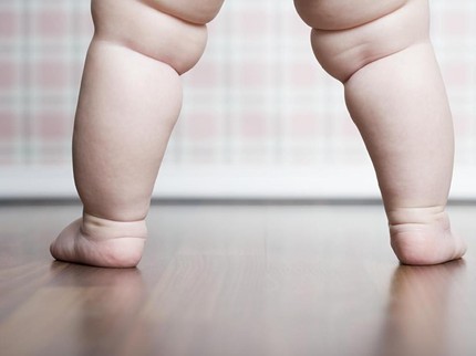 Bolehkah Balita Obesitas Menjalani Diet? Simak Penjelasan Dokter Bun