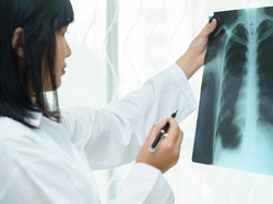 Mobilisasi dari Wuhan Tinggi, RI Perlu Waspadai Pneumonia China