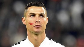 FOTO: Pesan Pipi Merah Ronaldo dan Pemain Lain di Liga Italia