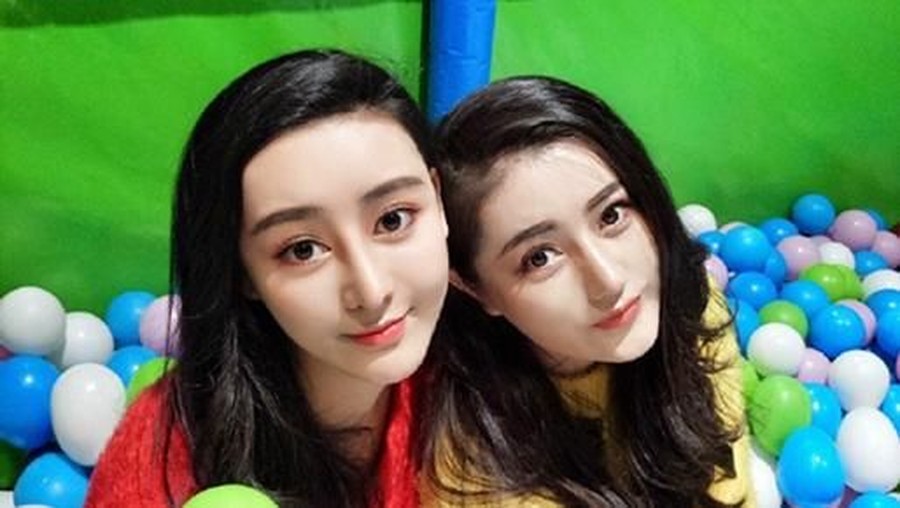 Operasi Plastik Mirip Artis