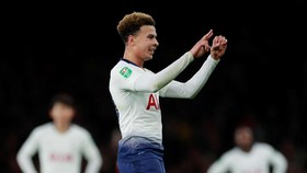 Pochettino: Pelempar Botol ke Dele Alli Harus Ditangkap
