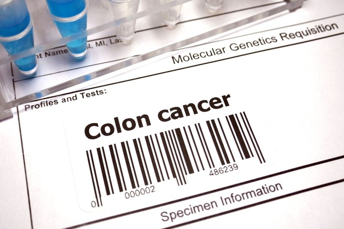 Genetic research abstract - Colorectal cancer