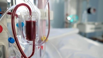 Mengenal Cuci Darah, Prosedur, dan Manfaatnya bagi Pasien Gagal Ginjal