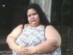 Titi Wati Wanita 220 Kg, Pernah Jalani Operasi Bariatrik Sebelum Ngetren