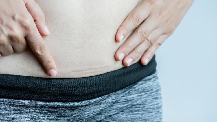 Closeup of woman showing on her belly dark scar from a cesarean section.