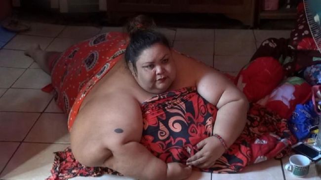 Selain Titi Wati, sejumlah kasus obesitas terekam oleh publik. Berikut CNNIndonesia.com merangkumnya.