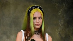 7 Model yang Dobrak Standar Kecantikan, Ubah Kekurangan Jadi Kelebihan