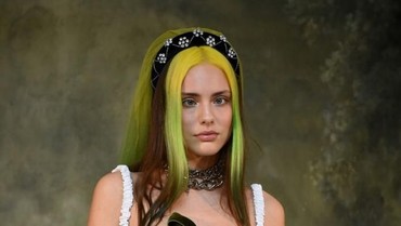 7 Model yang Dobrak Standar Kecantikan, Ubah Kekurangan Jadi Kelebihan