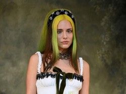 7 Model yang Dobrak Standar Kecantikan, Ubah Kekurangan Jadi Kelebihan