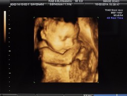 Diduga Korban Aborsi, Janin Bayi 3 Bulan Ditemukan di Sungai Bandung