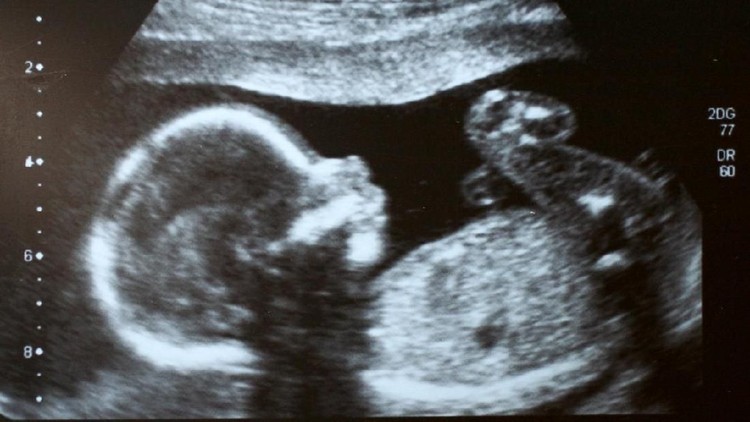 Saat kehmailan makin membesar, Bunda akan merasakan si kecil bergerak dan menendang. Simak yuk, Bun, gerakan apa saja yang dilakukan janin saat trimester dua.